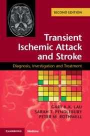 Transient Ischemic Attack and Stroke Diagnosis, Investigation and Treatment