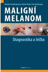 Maligní melanom – diagnostika a léčba