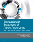 Endovascular Treatment...