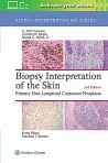 Biopsy Interpretation...
