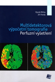  MULTIDETEKTOROVÁ VÝPOČETNÍ TOMOGRAFIE. PERFUZNÍ VYŠETŘENÍ