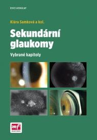 SEKUNDÁRNÍ GLAUKOMY