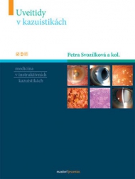 UVEITIDY V KAZUISTIKÁCH 