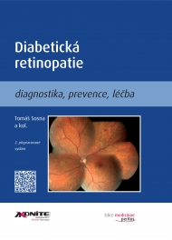 DIABETICKÁ RETINOPATIE, diagnostika, prevence, léčba