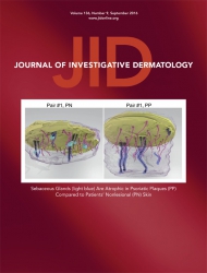 Journal of Investigative Dermatology