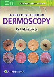  A Practical Guide to Dermoscopy