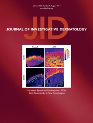 Journal of Investigative Dermatology