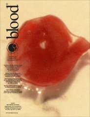 Blood    
