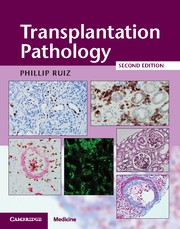 Transplantation Pathology with Online Resource