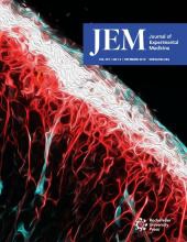 JEM