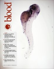 Blood 