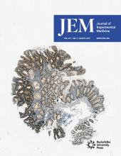 JEM