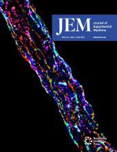 JEM