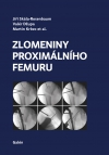 Zlomeniny proximálního femuru