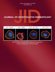 JID