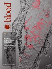 Blood 