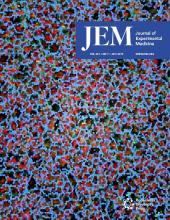 JEM
