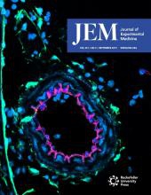 JEM