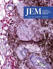 JEM
