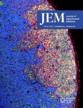 JEM