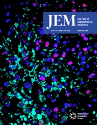 JEM