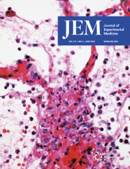 JEM