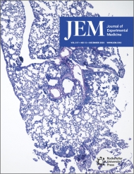 JEM