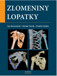 Zlomeniny lopatky