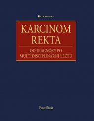 Karcinom rekta, od diagnózy po multidisciplinární léčbu 