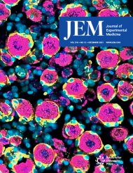 JEM