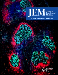 JEM