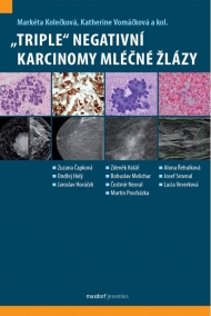 „Triple“ negativní karcinomy mléčné žlázy
