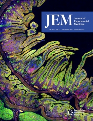 JEM