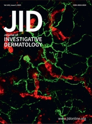 JID