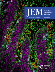 JEM