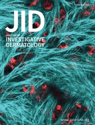 JID