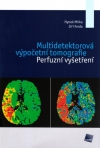  MULTIDETEKTOROVÁ...