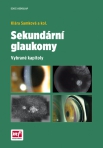  SEKUNDÁRNÍ GLAUKOMY