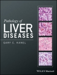 Pathology of Liver...