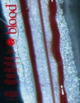 Blood   