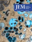 JEM
