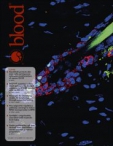 Blood 