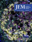 JEM