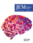 JEM