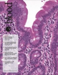Blood
