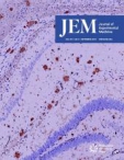 JEM 