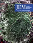 JEM
