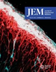 JEM