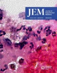 JEM
