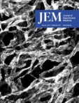 JEM